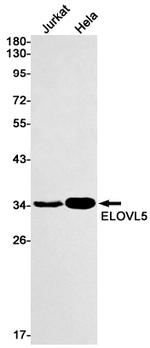 ELOVL5 Antibody in Western Blot (WB)