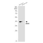 AHA1 Recombinant Rabbit Monoclonal Antibody (K01_1M49)