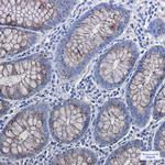 AGR2 Antibody in Immunohistochemistry (Paraffin) (IHC (P))