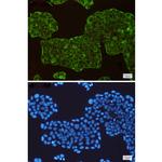 ASS1 Recombinant Rabbit Monoclonal Antibody (K01_1N14)