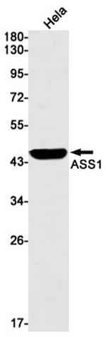 ASS1 Antibody in Western Blot (WB)