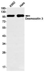 Desmocollin 3 Antibody in Western Blot (WB)