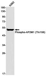 Phospho-AP2M1 (Thr156) Recombinant Rabbit Monoclonal Antibody (K01_1M85)