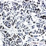 SRC1 Recombinant Rabbit Monoclonal Antibody (K01_1L01)