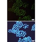 TRMT2A Antibody in Immunocytochemistry (ICC/IF)