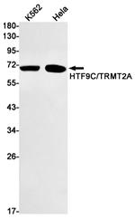 TRMT2A Antibody in Western Blot (WB)