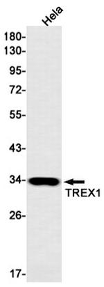TREX1 Antibody in Western Blot (WB)