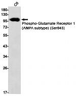 Phospho-GluR1 (Ser845) Antibody in Western Blot (WB)