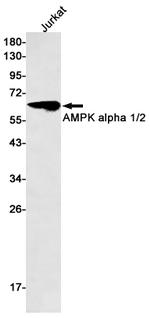 AMPK alpha-2 Recombinant Rabbit Monoclonal Antibody (K01_1L93)