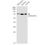 ARHGAP25 Recombinant Rabbit Monoclonal Antibody (K01_1N03)