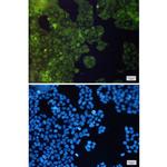 ADSS Recombinant Rabbit Monoclonal Antibody (K01_1M45)