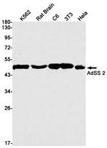 ADSS Antibody in Western Blot (WB)