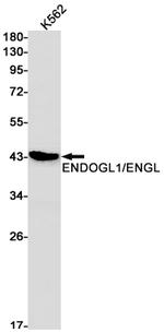 ENDOGL1 Recombinant Rabbit Monoclonal Antibody (K01_1K79)