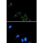 P2Y6 Recombinant Rabbit Monoclonal Antibody (K01_1K82)