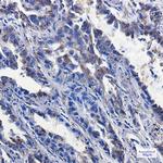 P2Y6 Antibody in Immunohistochemistry (Paraffin) (IHC (P))