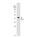 BIN1 Recombinant Rabbit Monoclonal Antibody (K01_1N57)