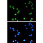 AP2 gamma Recombinant Rabbit Monoclonal Antibody (K01_1M84)