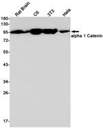 Catenin alpha-1 Recombinant Rabbit Monoclonal Antibody (K01_1M61)