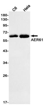 EOGT Recombinant Rabbit Monoclonal Antibody (K01_1M46)