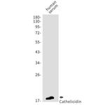 Cathelicidin Recombinant Rabbit Monoclonal Antibody (K01_1N95)