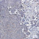 ATGL Recombinant Rabbit Monoclonal Antibody (K01_1M41)