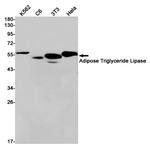ATGL Antibody in Western Blot (WB)