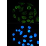ATF2 Recombinant Rabbit Monoclonal Antibody (K01_1M12)