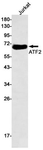ATF2 Antibody in Western Blot (WB)