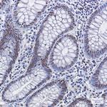Phospho-MDM2 (Ser166) Antibody in Immunohistochemistry (Paraffin) (IHC (P))