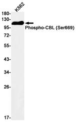 Phospho-c-Cbl (Ser669) Recombinant Rabbit Monoclonal Antibody (K01_1N99)