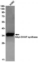 AGPS Antibody in Western Blot (WB)