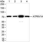 ATP6V1A Antibody in Western Blot (WB)