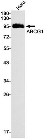 ABCG1 Recombinant Rabbit Monoclonal Antibody (K01_1L53)