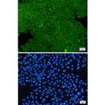 Annexin A2 Recombinant Rabbit Monoclonal Antibody (K01_1M78)