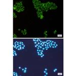 PKR Recombinant Rabbit Monoclonal Antibody (K01_1K85)
