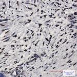 PKR Antibody in Immunohistochemistry (Paraffin) (IHC (P))