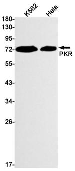 PKR Antibody in Western Blot (WB)
