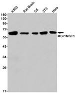 MST1 (STK4) Antibody in Western Blot (WB)