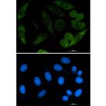 Profilin 1 Recombinant Rabbit Monoclonal Antibody (K01_1L33)