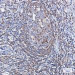 Profilin 1 Antibody in Immunohistochemistry (Paraffin) (IHC (P))
