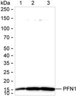 Profilin 1 Antibody in Western Blot (WB)