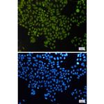 APE1 Recombinant Rabbit Monoclonal Antibody (K01_1M88)
