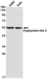 ANGPTL4 Recombinant Rabbit Monoclonal Antibody (K01_1M74)