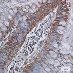 Carbonic Anhydrase I Recombinant Rabbit Monoclonal Antibody (K01_1N84)