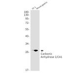 Carbonic Anhydrase I Antibody in Western Blot (WB)