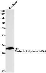 Carbonic Anhydrase I Antibody in Western Blot (WB)