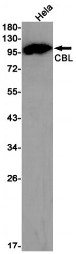 c-Cbl Antibody in Western Blot (WB)