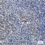 Artemin Recombinant Rabbit Monoclonal Antibody (K01_1N07)