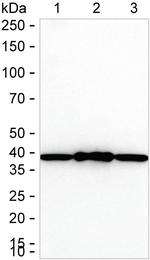 ATP6V0D1 Antibody in Western Blot (WB)