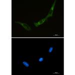 PKR Recombinant Rabbit Monoclonal Antibody (K01_1L34)